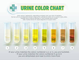 Yellow Urine Reasons