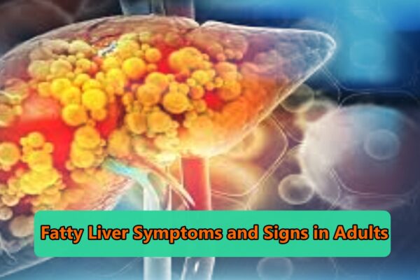 Fatty Liver Symptoms and Signs in Adults