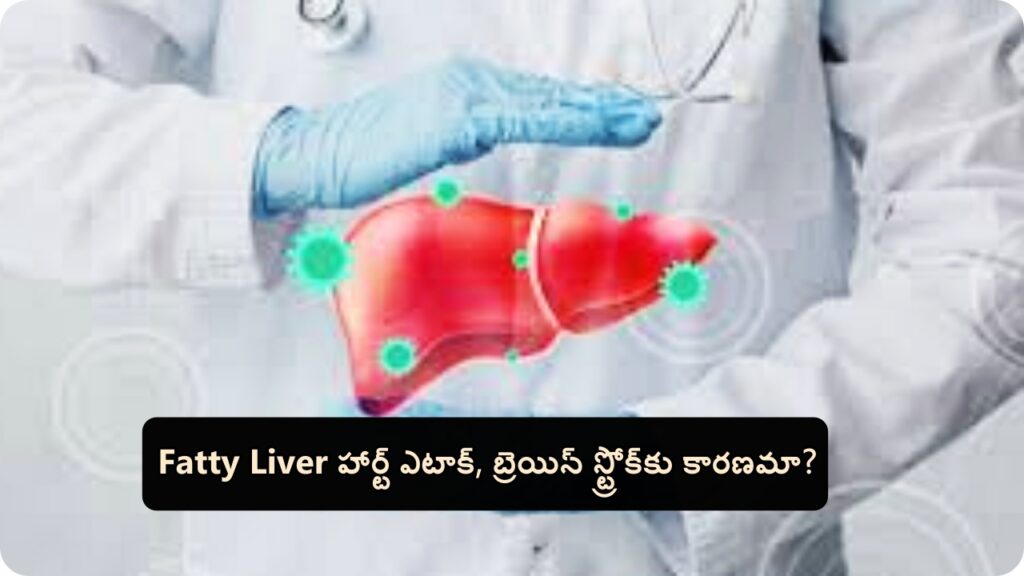  Fatty Liver హార్ట్ ఎటాక్, బ్రెయిన్ స్ట్రోక్‌కు కారణమా?