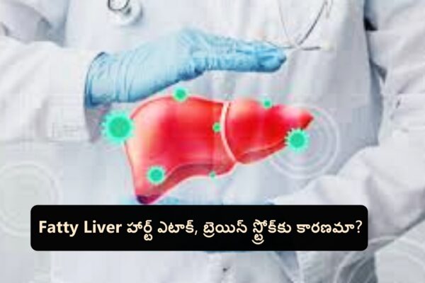 Fatty Liver హార్ట్ ఎటాక్, బ్రెయిన్ స్ట్రోక్‌కు కారణమా?