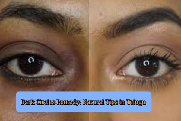 Dark Circles Remedy: Natural Tips in Telugu