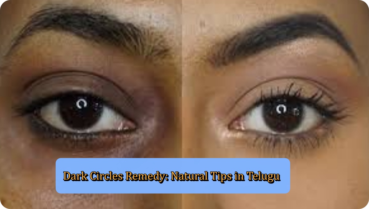 Dark Circles Remedy: Natural Tips in Telugu